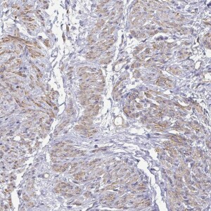 Anti-MYL6, IgG, Rabbit, Polyclonal