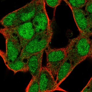 Anti-C17orf100, IgG, Rabbit, Polyclonal