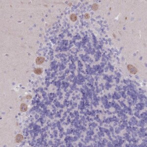 Anti-PIGM, IgG, Rabbit, Polyclonal