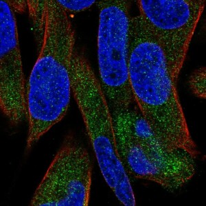 Anti-UGT3A1, IgG, Rabbit, Polyclonal