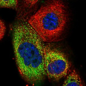 Anti-TRIM73, IgG, Rabbit, Polyclonal
