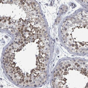 Anti-PTPN20, IgG, Rabbit, Polyclonal
