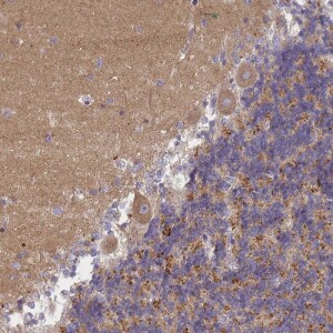 Anti-AP3M1, IgG, Rabbit, Polyclonal