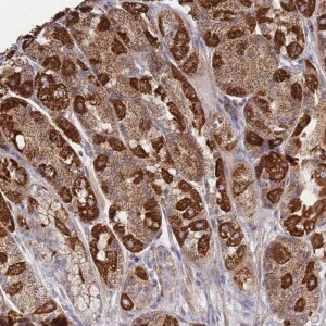Anti-IKZF4, IgG, Rabbit, Polyclonal