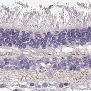 Anti-SLC1A7, IgG, Rabbit, Polyclonal