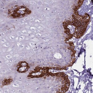 Anti-CNPPD1, IgG, Rabbit, Polyclonal