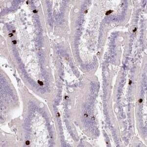 Anti-HTR3E, IgG, Rabbit, Polyclonal