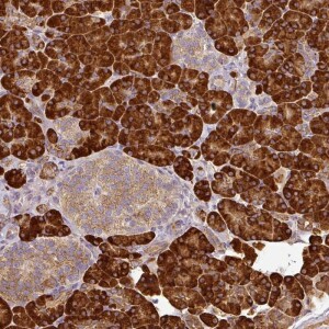 Anti-ANKRD18A, IgG, Rabbit, Polyclonal