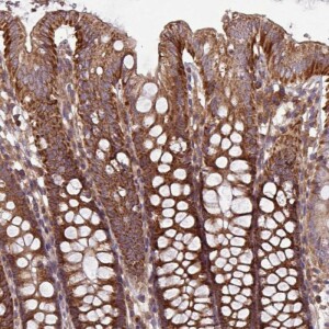 Anti-PLEKHD1, IgG, Rabbit, Polyclonal