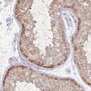 Anti-MAGEC3, IgG, Rabbit, Polyclonal