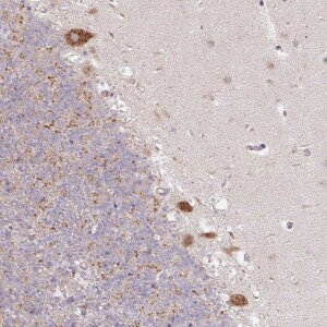 Anti-MLX, IgG, Rabbit, Polyclonal