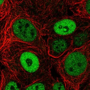 Anti-BCL9L, IgG, Rabbit, Polyclonal