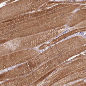 Anti-FAM65C, IgG, Rabbit, Polyclonal