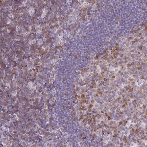 Anti-TIGD2, IgG, Rabbit, Polyclonal