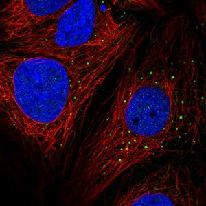 Anti-AP1M2, IgG, Rabbit, Polyclonal