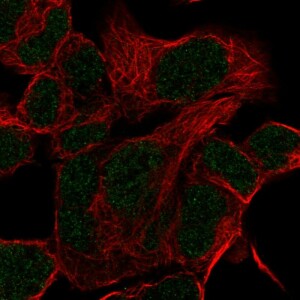 Anti-HOXD11, IgG, Rabbit, Polyclonal