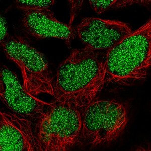 Anti-TM2D1, IgG, Rabbit, Polyclonal