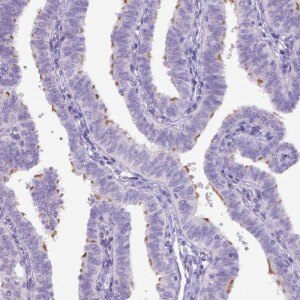 Anti-DNAH11, IgG, Rabbit, Polyclonal