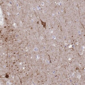 Anti-GRB7, IgG, Rabbit, Polyclonal