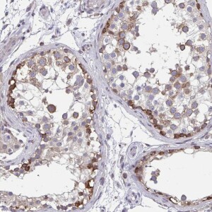 Anti-ZNF778, IgG, Rabbit, Polyclonal