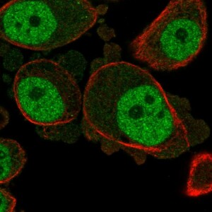 Anti-KCNN3, IgG, Rabbit, Polyclonal