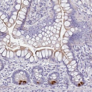 Anti-FBXO47, IgG, Rabbit, Polyclonal