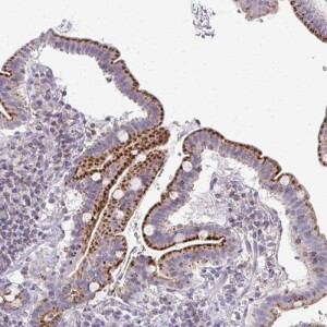 Anti-VPS4B, IgG, Rabbit, Polyclonal
