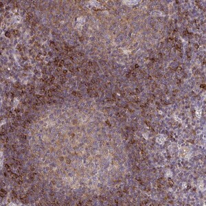 Anti-SLC9A9, IgG, Rabbit, Polyclonal