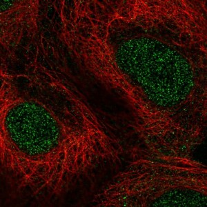 Anti-PPARA, IgG, Rabbit, Polyclonal