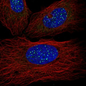 Anti-TINF2, IgG, Rabbit, Polyclonal
