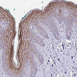 Anti-GSG1L2, IgG, Rabbit, Polyclonal