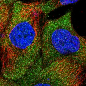 Anti-SAMD4B, IgG, Rabbit, Polyclonal