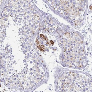 Anti-ZSCAN5B, IgG, Rabbit, Polyclonal