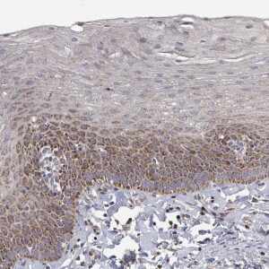 Anti-MRPL3, IgG, Rabbit, Polyclonal
