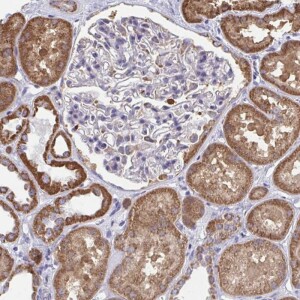 Anti-RCC1L, IgG, Rabbit, Polyclonal
