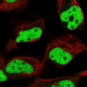 Anti-MLH1, IgG, Rabbit, Polyclonal