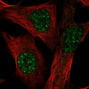 Anti-TMEM179B, IgG, Rabbit, Polyclonal