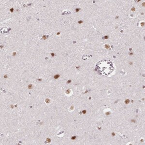 Anti-HNRNPDL, IgG, Rabbit, Polyclonal