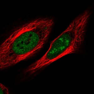 Anti-ZNF554, IgG, Rabbit, Polyclonal