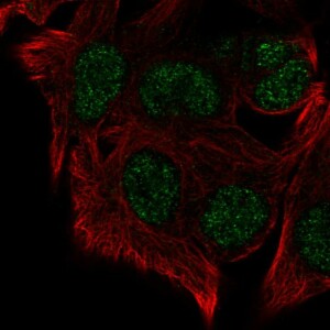 Anti-KMT5B, IgG, Rabbit, Polyclonal