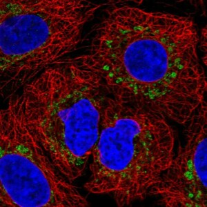 Anti-FXYD2, IgG, Rabbit, Polyclonal