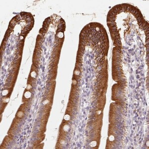 Anti-TMSB15B, IgG, Rabbit, Polyclonal