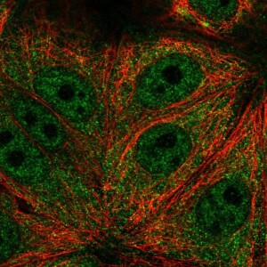 Anti-TRIM65, IgG, Rabbit, Polyclonal