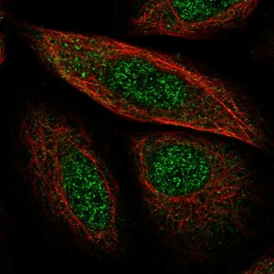 Anti-SYCP2, IgG, Rabbit, Polyclonal