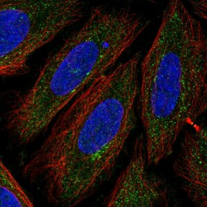 Anti-TTPAL, IgG, Rabbit, Polyclonal