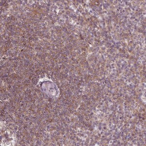 Anti-ADAM33, IgG, Rabbit, Polyclonal