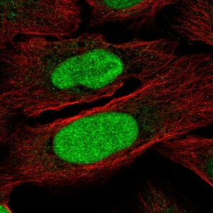Anti-ZNF776, IgG, Rabbit, Polyclonal