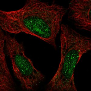 Anti-ATXN3, IgG, Rabbit, Polyclonal