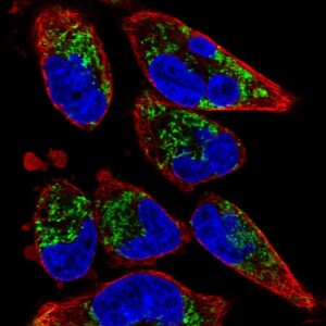 Anti-TMEM71, IgG, Rabbit, Polyclonal