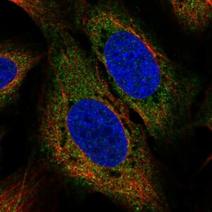 Anti-USP15, IgG, Rabbit, Polyclonal